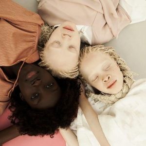 Конкурс красоты альбиносов Африки - фото 1
